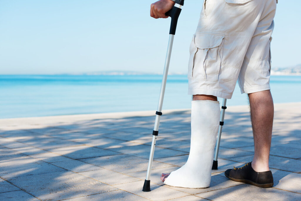 accident abroad, leg injury compensation solicitors Manchester